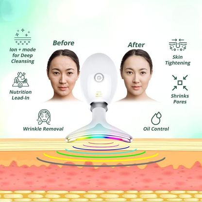 Face Lift Device | 7 Color LED